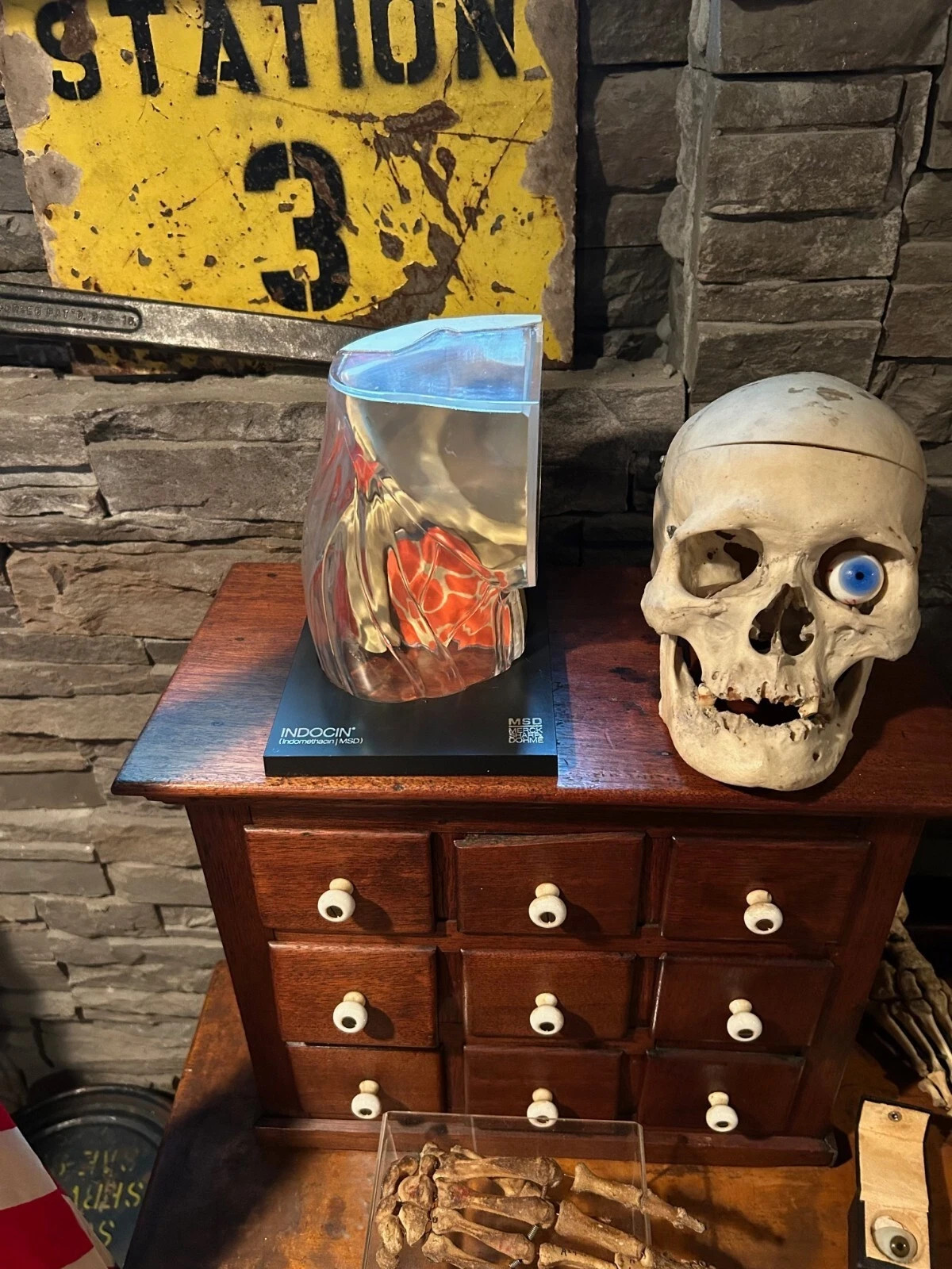 Vintage Medical Anatomical Knee Model Merck - Indocin