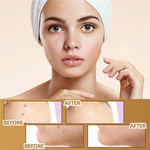 Skin Invisible Concealer Stickers Invisible Sticker Scar Tattoo Covering Patches - Picture 8 of 14