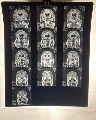 MRI CT Brain Scans X-Rays Medical Skull Prop Halloween Lot of 10 (A5)