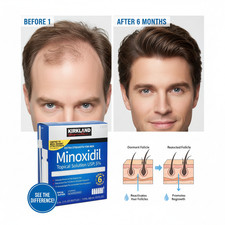 KIRKLAND Minoxidil 5 Extra Strength Men Hair Regrowth Solution 6 Month Supply