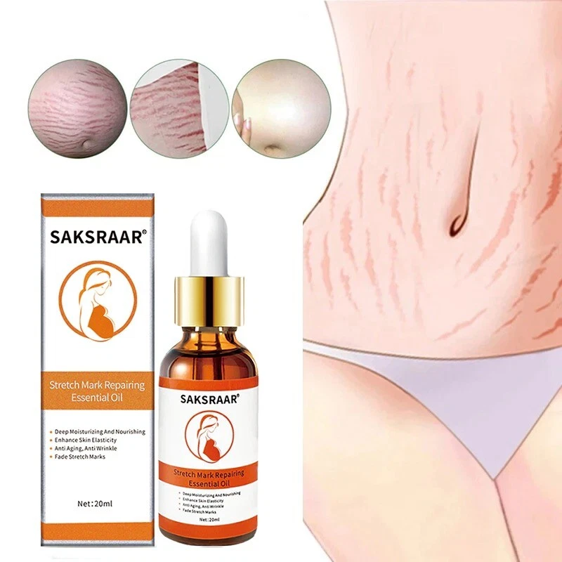 Stretch Marks Remover Essential Oil Skin Care Treatment Cream For