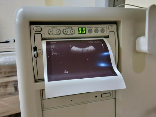 Philips HD11 XE Ultraschall - Bild 3 von 9