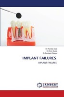 Implant Failures Sandesh Gosavi