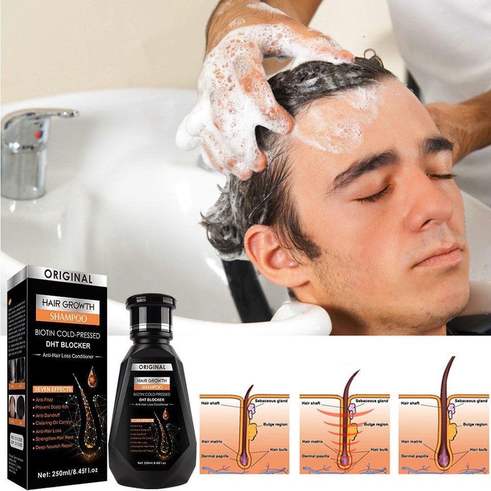 250ml Anti Hair Loss Shampoo Natural Ginger Hair Growth Shampoo for Men