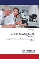Adma Aijaz (U. A.) | Benign Salivary Gland Tumors | Taschenbuch | Englisch