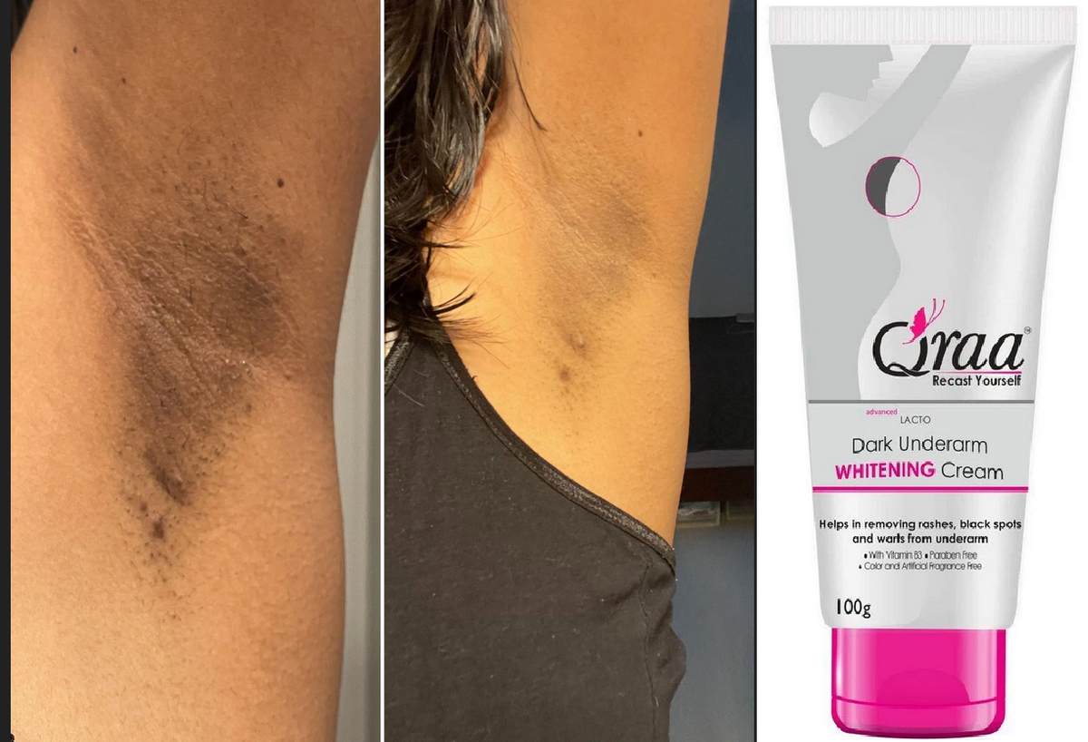 glutathione underarm whitening cream Qraa Advanced Lacto Dark Underarm Cream -For Uneven Skin Tone and Underarms