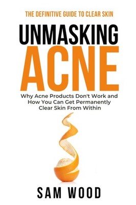 Unmasking Acne: The Definitive Guide to Clear Skin: Why Acne Products Don t Work