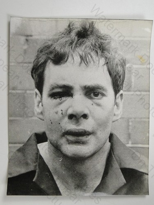 #ad Donald Neilson Black Panther Police Arrest Photo Facial Injuries 1976 Press GBP 25.00