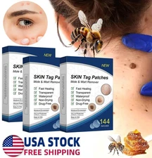 144PCS Skin Tag Remover Patches Quick Effective Mole Wart Removal Pad Sticker US