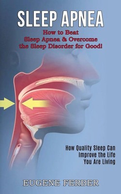 Sleep Apnea Eugene Ferber Taschenbuch Kartoniert / Broschiert Englisch 2021
