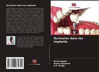Occlusion Dans Les Implants Roma Goswami
