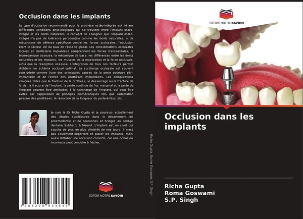 Occlusion Dans Les Implants Roma Goswami-image