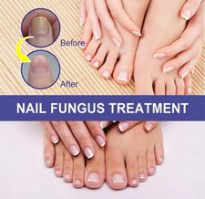 Nail Care Serum 10ml Nail Repair Liquid for Damaged Nails Treatment