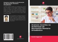 AvançOs Recentes Na AceleraçãO Do Movimento DentáRio OrtodôNtico Kanish Aggarwal
