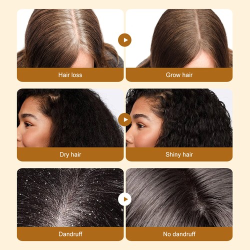 5/3 x Batana Öl Für Haarwachstum Haarausfall Behandlung Bio-Batana-Öl Haarpflege - Bild 39 von 41