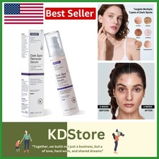 Dark Spot Remover Lotion for Face and Body, Fades Sun, Age, Freckle  Melasma...
