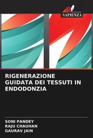 Soni Pandey (U. A.) | Rigenerazione Guidata DEI Tessuti IN Endodonzia | Buch