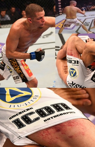 Dan Henderson Signed 11x14 Photo BAS COA UFC Picture w Pride FC StrikeForce Belt - Picture 16 of 24