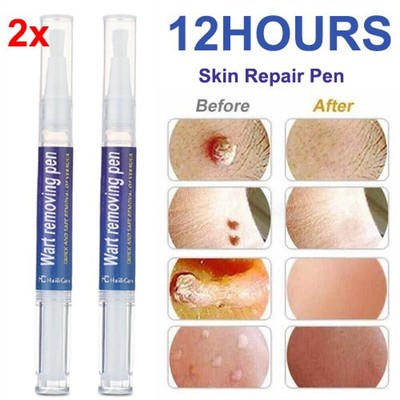 2X 5ML Skin Tag Remover Pen Skin Tag Mole Wart Dark Spot Remover Painless & Safe
