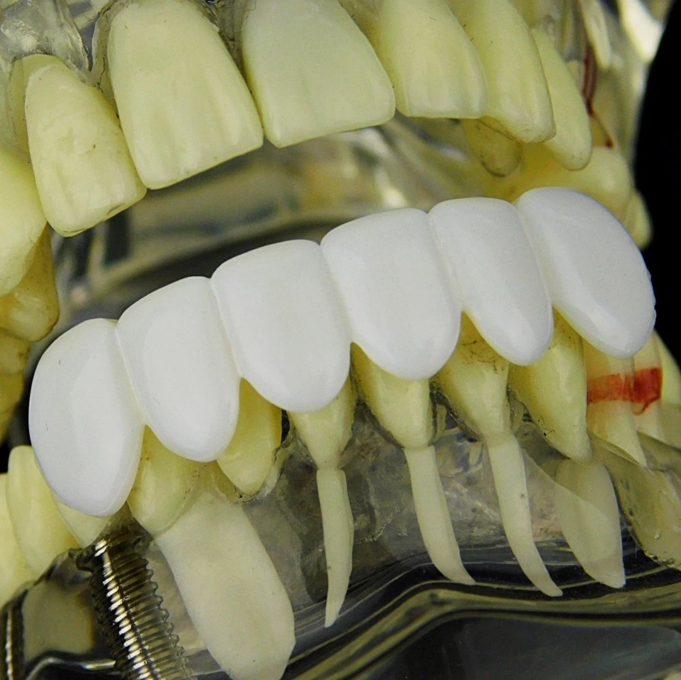 Pure White Teeth Grillz Bottom Teeth Six PC Hip Hop Mouth Grill Pre-Made Grills - Image 2 of 4