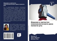 Binola B (U. A.) | Inwaziq I Metastaz Ploskokletochnogo Raka Polosti Rta | Buch