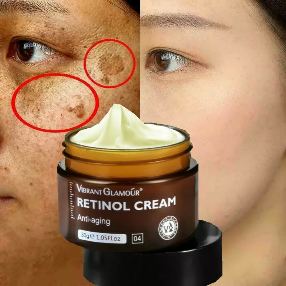 Retinol Cream Face Anti Aging Serum Remove Wrinkle Melasma Acne Dark Spots  30ML