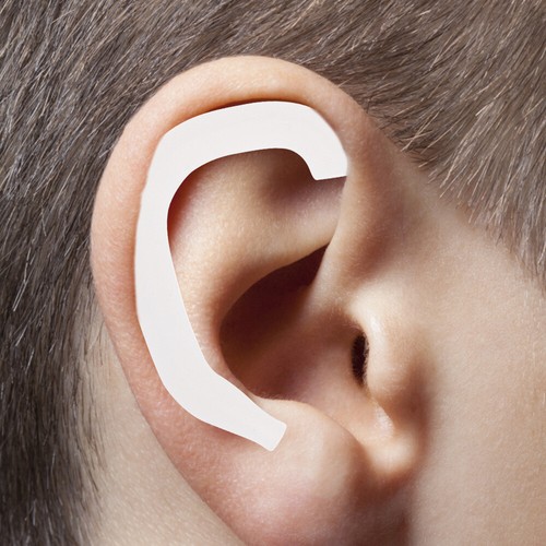 6 Pairs Ear Infant Shaper Child Newborn Baby Corrector - Photo 2 sur 10