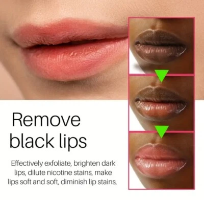 NAXR 2pcs Lip Lightening Bleaching Cream Effective Treatment Remove Dark Smoker Balm