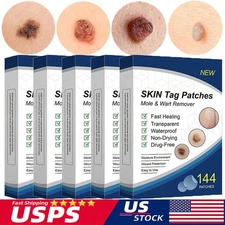 720pc Skin Tag Remover Patches Quick Effective Mole and Wart Pad Removal Sticker