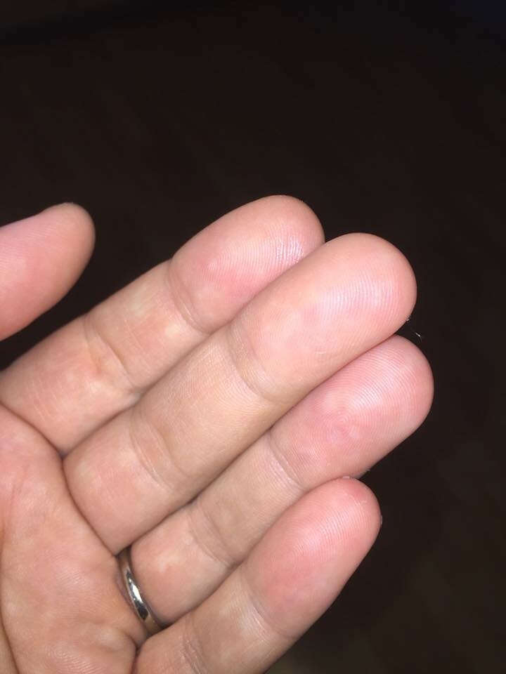 Picture 12 of 12