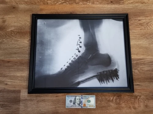 Nikola Tesla — Foot in Boot X Ray Roentgen Ray — Photo Wall Art — HQ