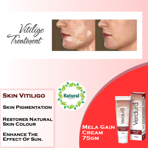 Melagain Cream Treatment For Vitiligo 75g For Sensitive Skin & Uneven Skin Tone - Picture 1 of 17