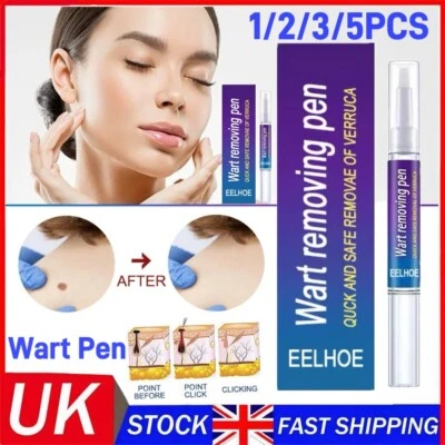 6PACK 12 Hours Wart Remover Pen Skin Tag Mole Remover Eliminate Foot Corn Warts
