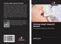 Reeta Jain | Scienza Degli Impianti Dentali | Taschenbuch | Italienisch (2021)