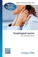 Lydia D. Thomson-Smith | Esophageal Cancer | Taschenbuch | Englisch (2012)