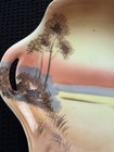 Vintge Meito China Hand Painted Trinket Dish w/ Handles Sunset Scene 6.25" width — photo 3