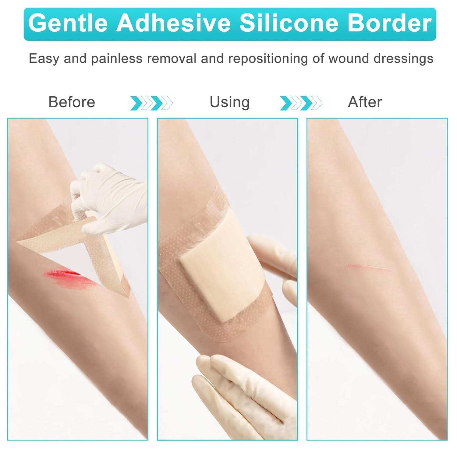 Silicone Foam Dressing 4“ x 4” with Adhesive Border,10 Packs Waterproof Silicone