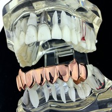 14k Rose Gold Plated Dracula Fang Grillz Bottom 8 Eight Teeth Vampire Fangs