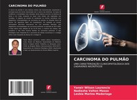 Carcinoma Do PulmÃO Yaneir Wilson Laurencio