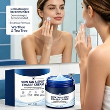 7-Day Skin Tag Spot Eraser Cream, Advanced Imperfection Removal Cream 30ml