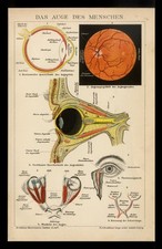 Original Lithographie von 1896 Das Auge Augenarzt Anschaungstafel Lehrtafel