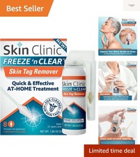Skin Tag Remover - Cryogenic Kit with 8 Precision-Tip Applicators  Tweezers ...