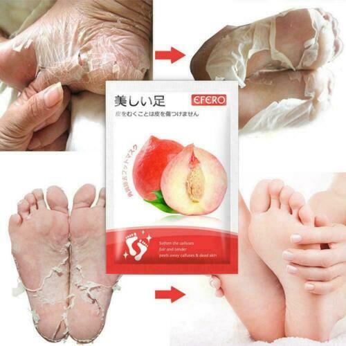 Pretty Feet & Hands – Peeling Gegen Raue Haut An Füßen & Händen (3 Fl.oz / 89 Ml)