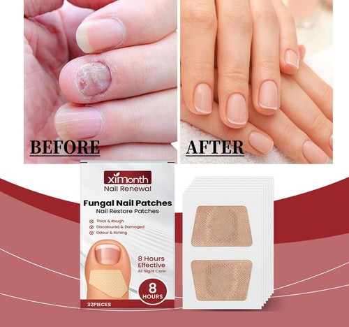 Pilz Nagel Patchees Nagel Restore Patches Für Nagelpflege