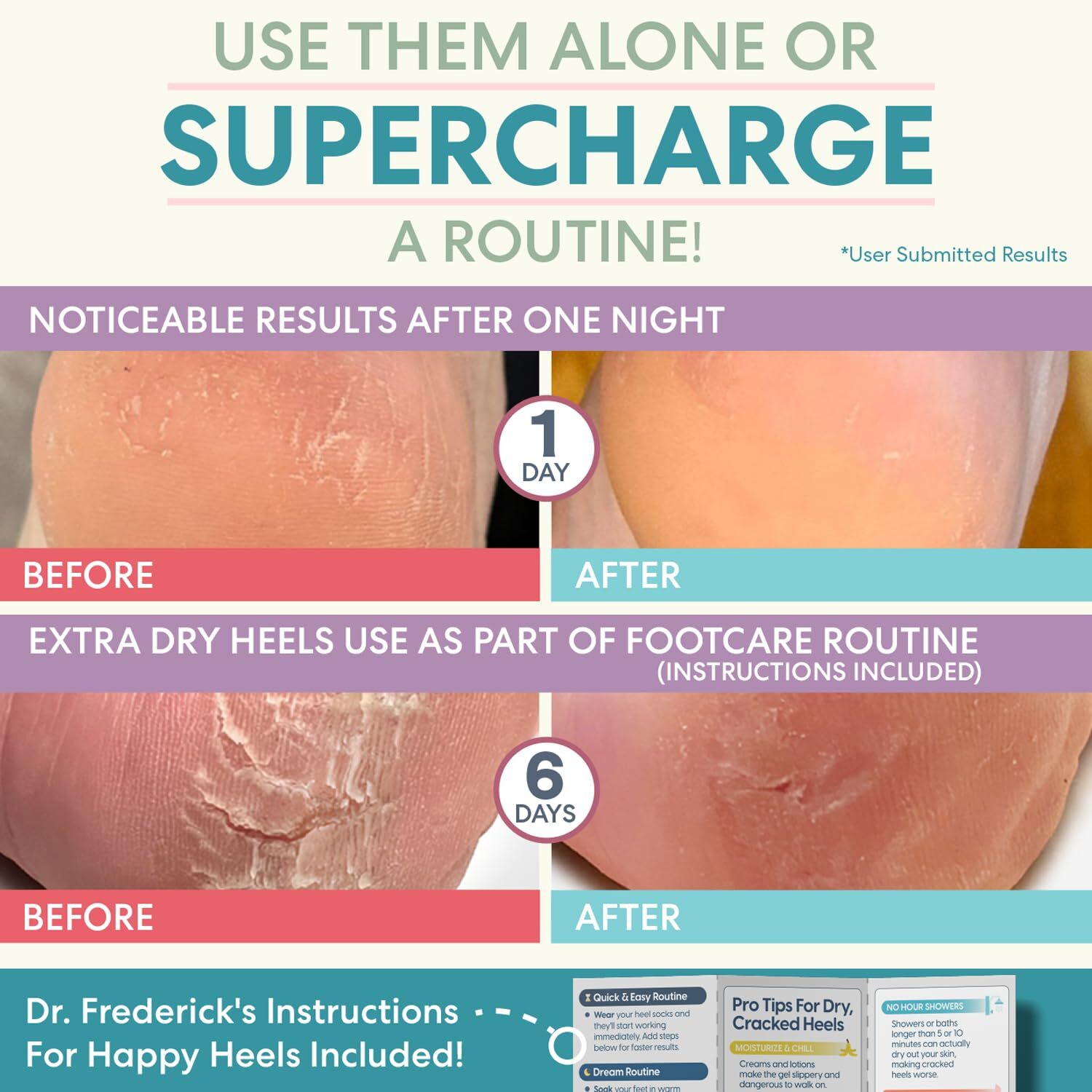 Moisturizing Heel Socks for Cracked Heel Treatment - 2 Pairs - Socks for Dry ...