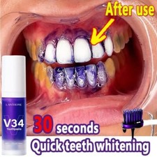 Limpieza Dental Blanqueamiento Quitar Manchas Blanqueamiento Dental Fresco NEW