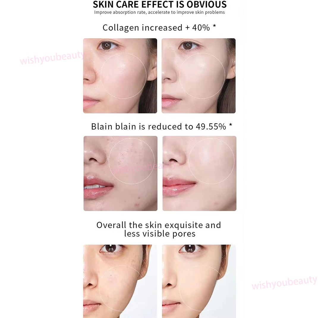 Micro Pen Mesotherapy Gun With 10Pcs 42Pins Replacement Needles Cartridges Tips