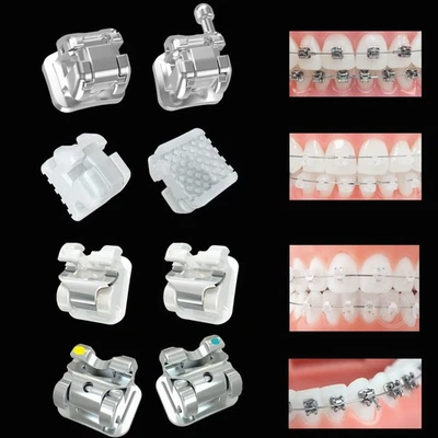 CREATIVE Dental Brackets Orthodontic Self Ligating Braces Metal Ceramic Roth MBT 022 345