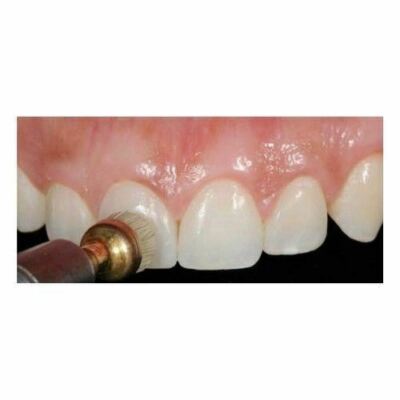 Flairesse Single Dose - Pasta Lucidante Per Profilassi (200u) - DMG - Foto 2