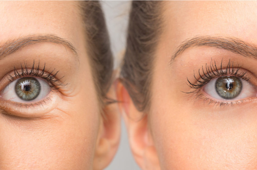 アイケア HERMITISE AD IMMEDIATE EYE LIFT 10ml HERMITISE AD IMMEDIATE EYE LIFT 10ml